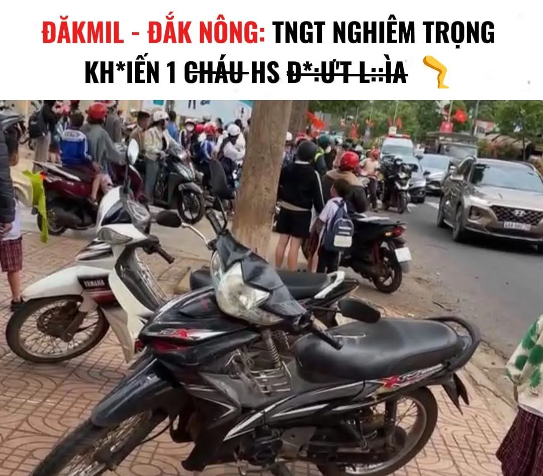 Đắk Mil Đắk Nông: TNGT khiến 1 bé gái đứt lìa 1 chân