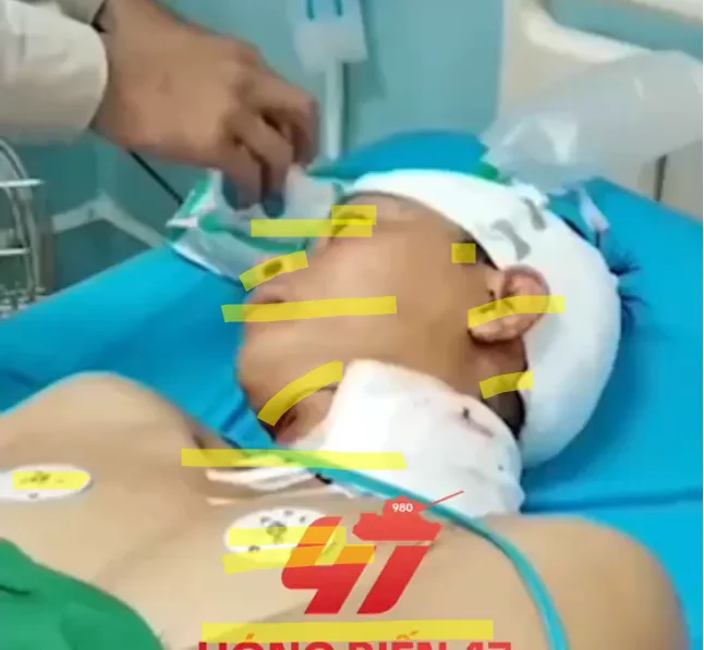 Chồng đang ngủ, bị vợ che’m nhiều nhát vào đầ~u